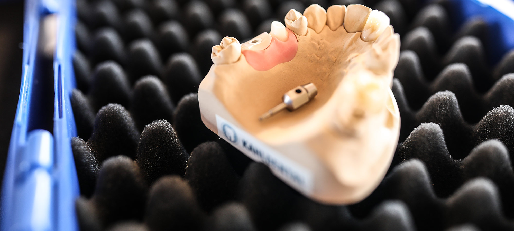Gingivaformer